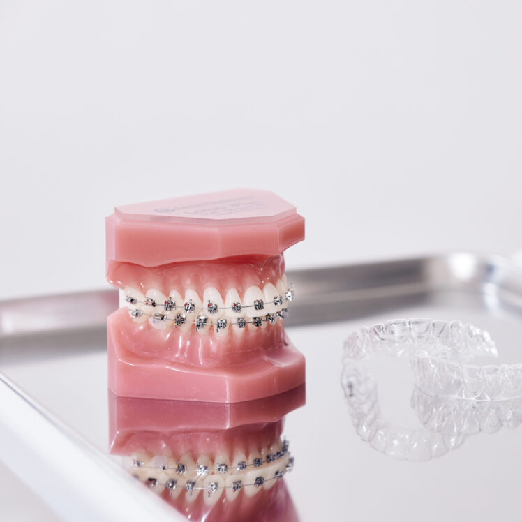 自鎖式金屬矯正